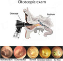 Cross Canada 11-125 Physician Fiber Optic LED Pocket Otoscope Diagnostic Set